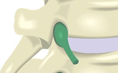 What Sort of Treatment Can I Expect from your Chiropractor?