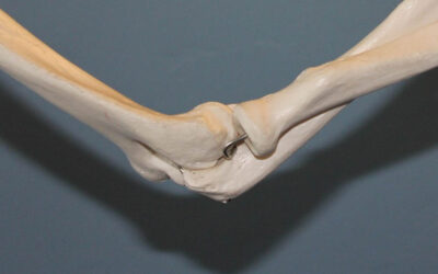 Help with Joint Inflammation