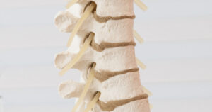 What is a Herniated Disc?